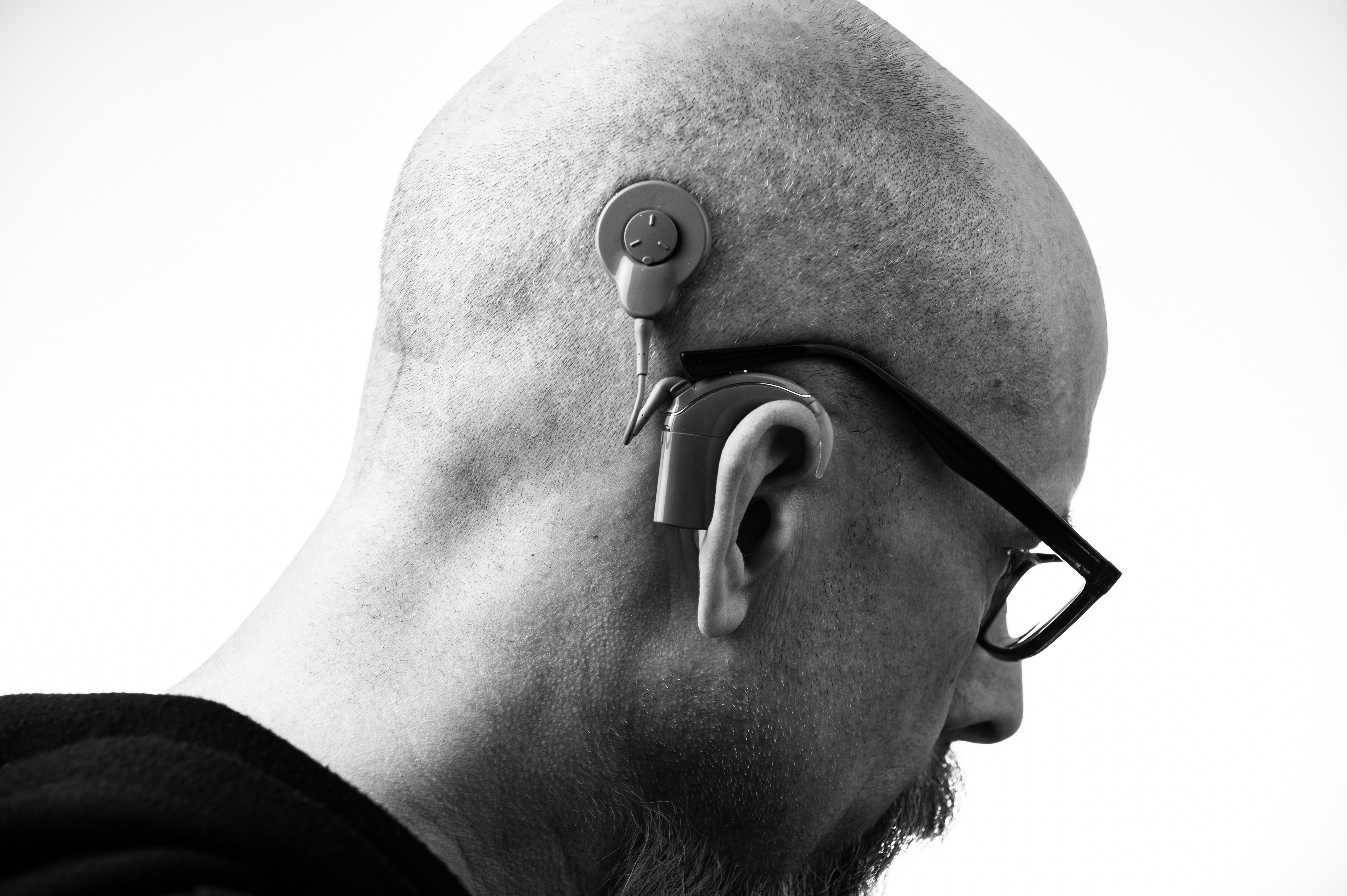 Hearing Loss - What to Do?